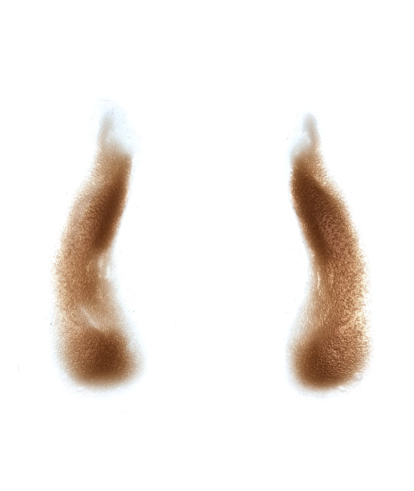 Female Nasolabial Folds with Jowls 5