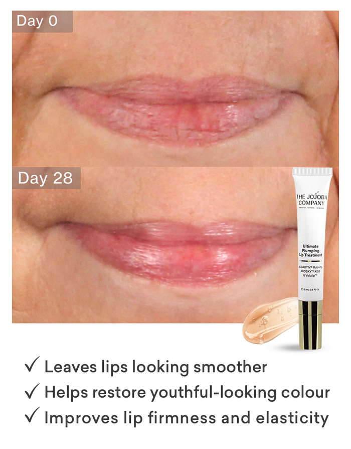 Before and after slide of woman with lips