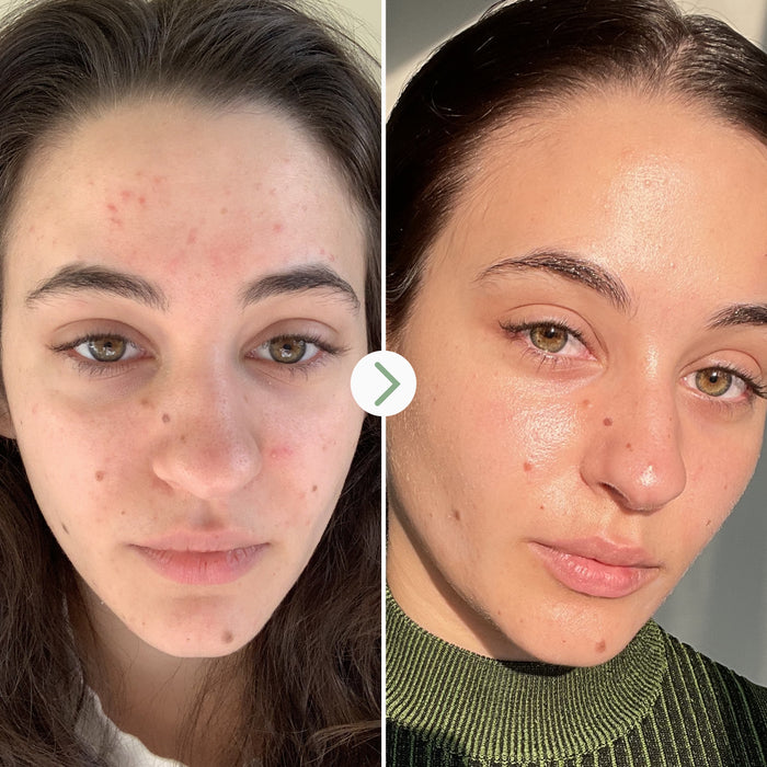 Pai Skincare-Carbon Star-Skincare-5060139726894_5-The Detox Market |