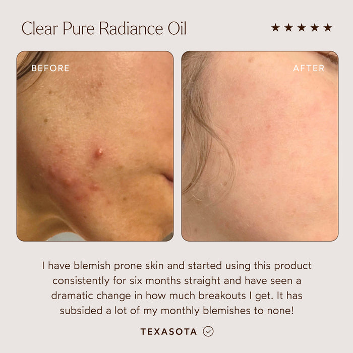 True Botanicals-CLEAR Pure Radiance Oil-Skincare-S-W-D-PRC1-R-3_997891e2-f869-409a-8d7e-69c8f642aaf4-The Detox Market |