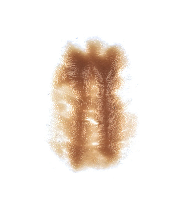 Female Neck Waddle 7