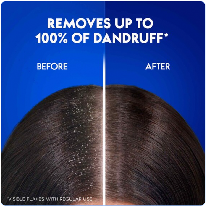 Head & Shoulders Citrus Fresh Anti-Dandruff Shampoo - 200ml, Shampoo