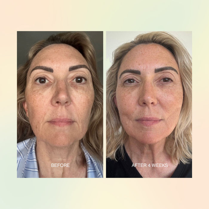 Before and after comparison of a woman's face with visible skin improvement over 4 weeks.