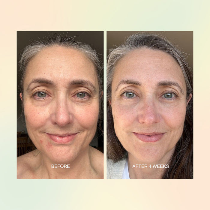 Before and after comparison of a woman's face with text indicating time elapsed.