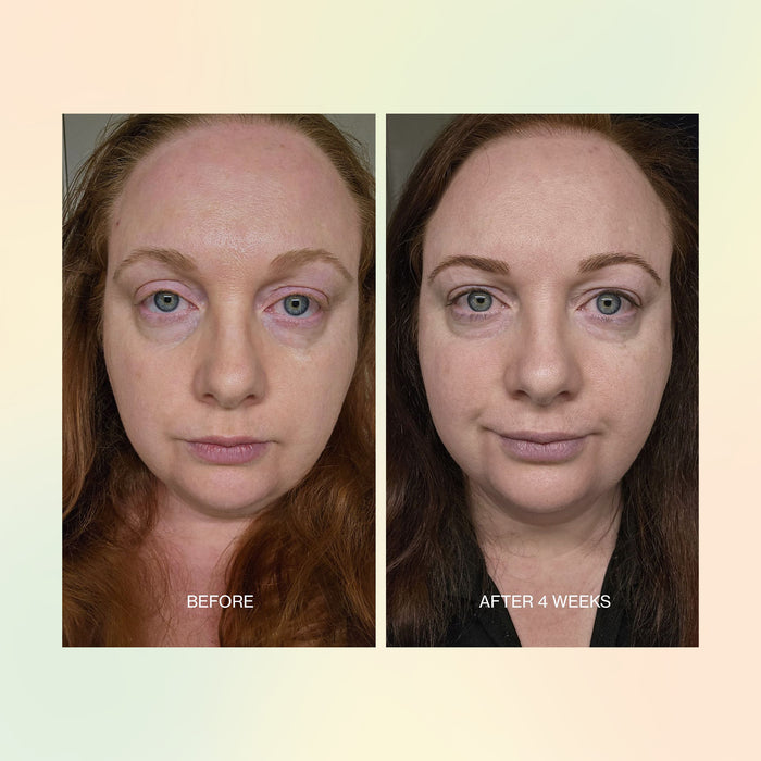 Before and after comparison of a woman's face with text indicating time elapsed.