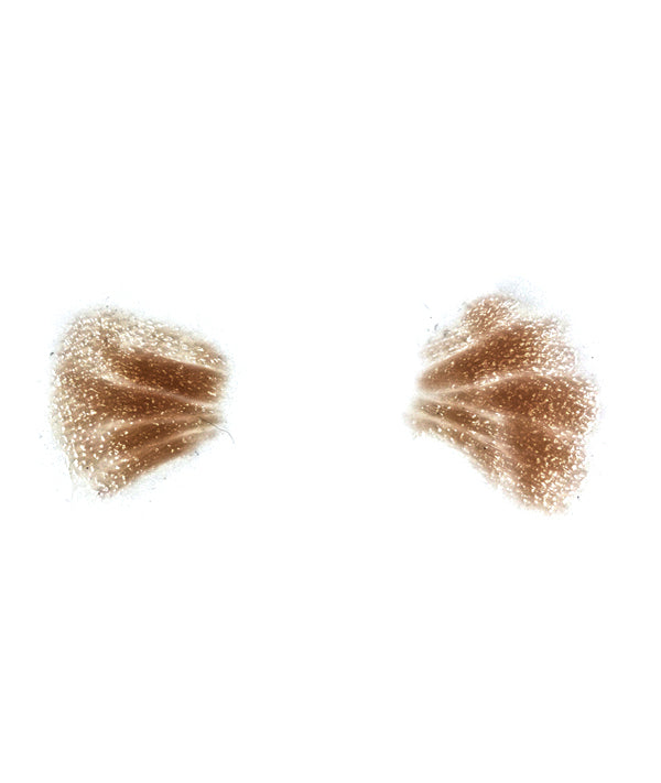 Male Crows Feet 2