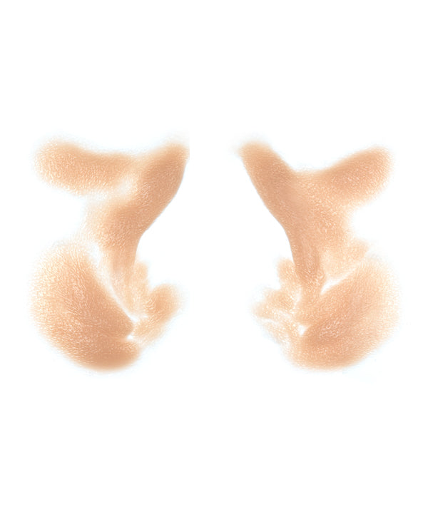 Male Nasolabial Folds and Jowls 12