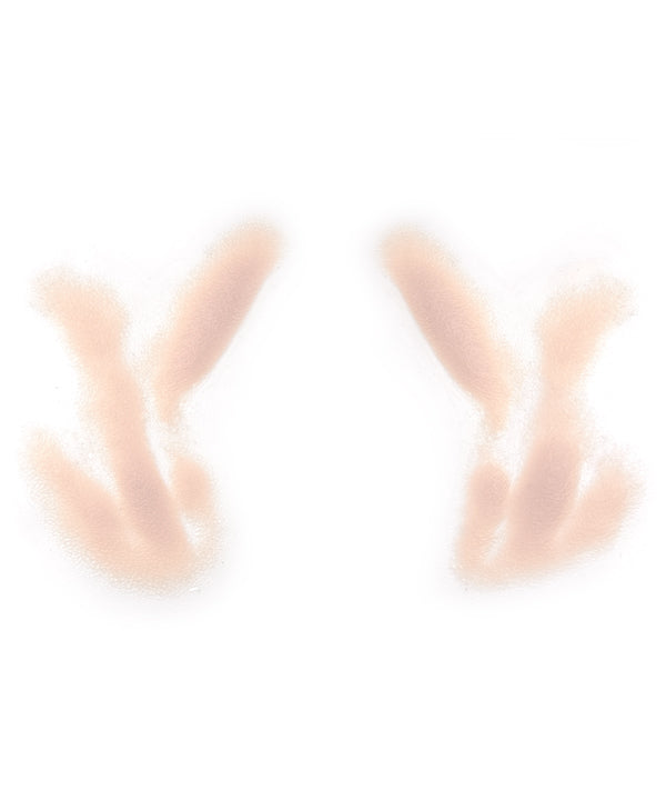 Male Nasolabial Folds and Jowls 5