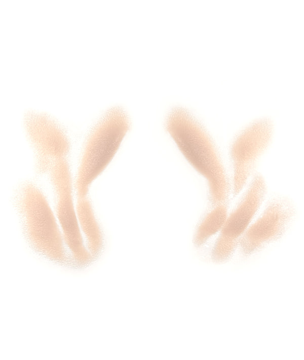 Male Nasolabial Folds and Jowls 6