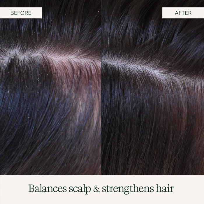 Rahua-Scalp Exfoliating Shampoo-Hair-ScalpExfoliating_Shampoo_9.3_PDP_6-The Detox Market |