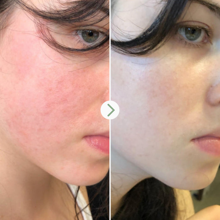 Pai Skincare-The Light Fantastic-Skincare-5060139726696_5-The Detox Market |