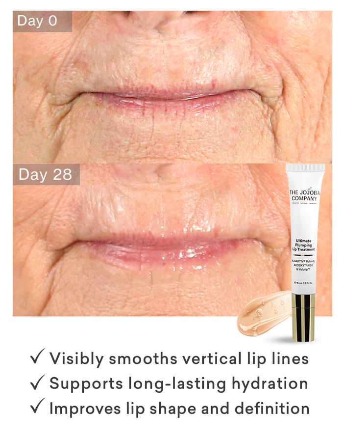 Before and after slide of woman with lips