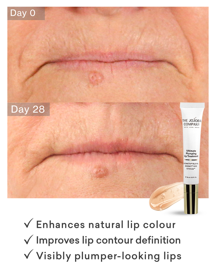 Before and after slide of woman with lips